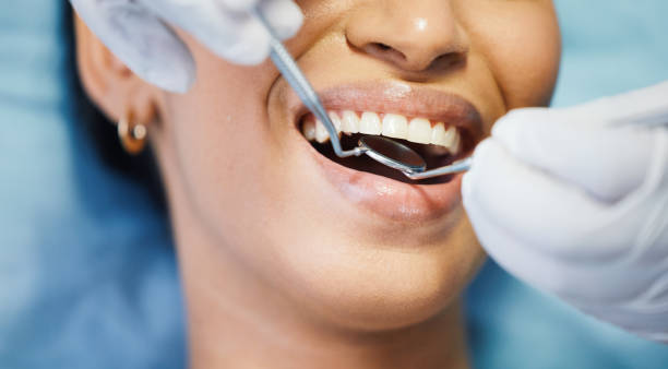 Best Weekend Emergency Dental Services in Fircrest, WA